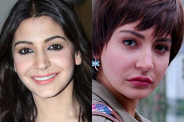 anushka chopra plastic surgery