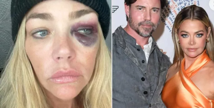 Denise Richards, Aaron Phyhers