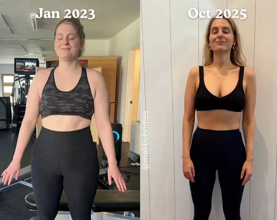 Why Did Meghan Trainor's Before And After Pics Go Viral  Again? Know Its Link To Her New Song, 'Still Don't Care' 5