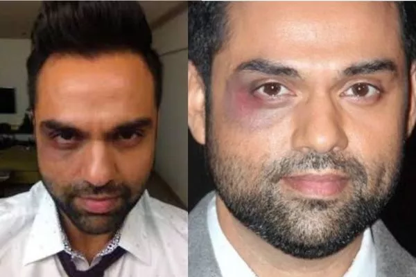 Abhay Deol black eye look