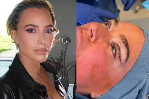 teddi