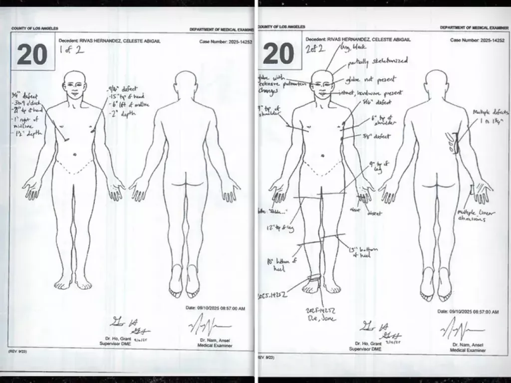 autopsy