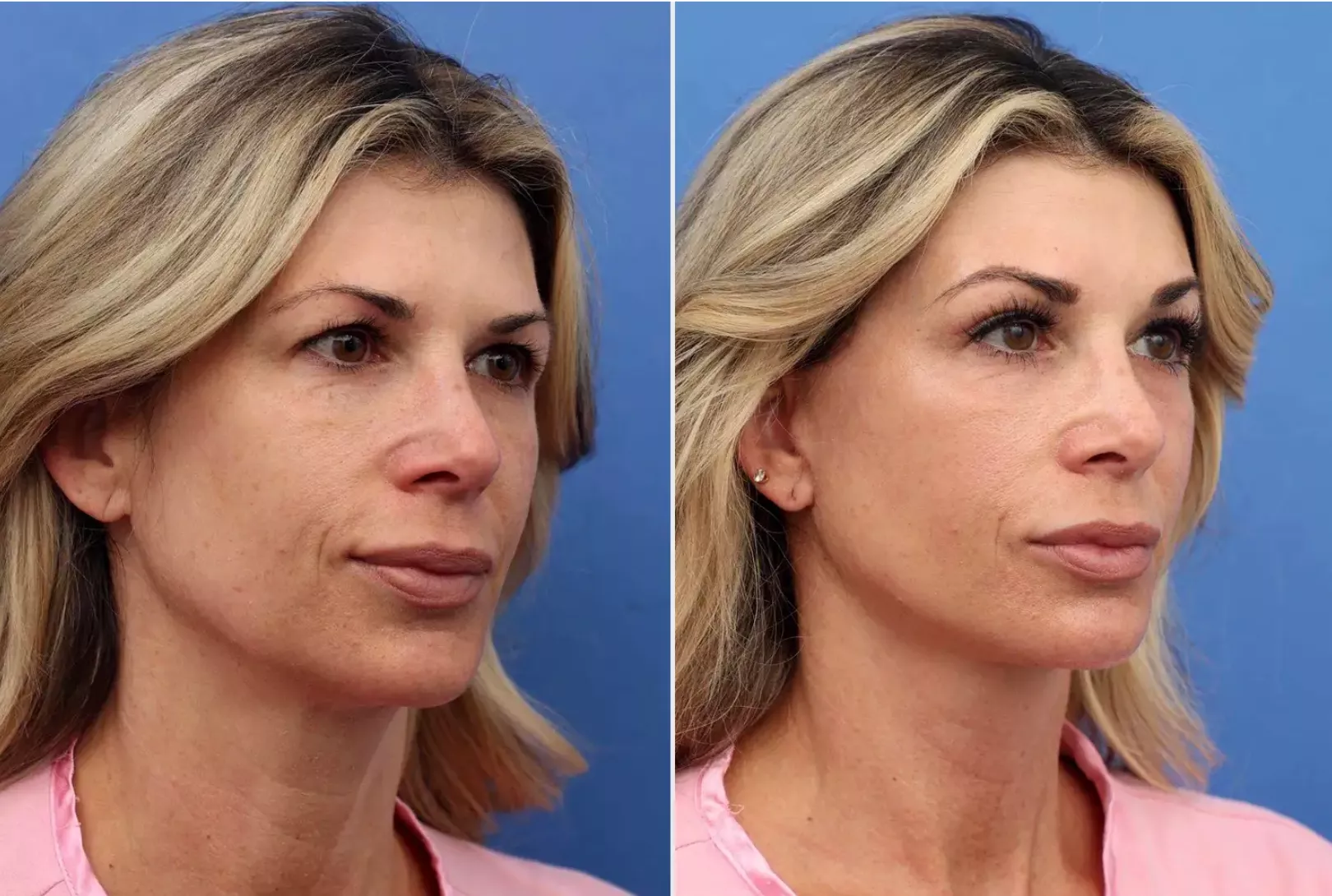 Alexis Bellino