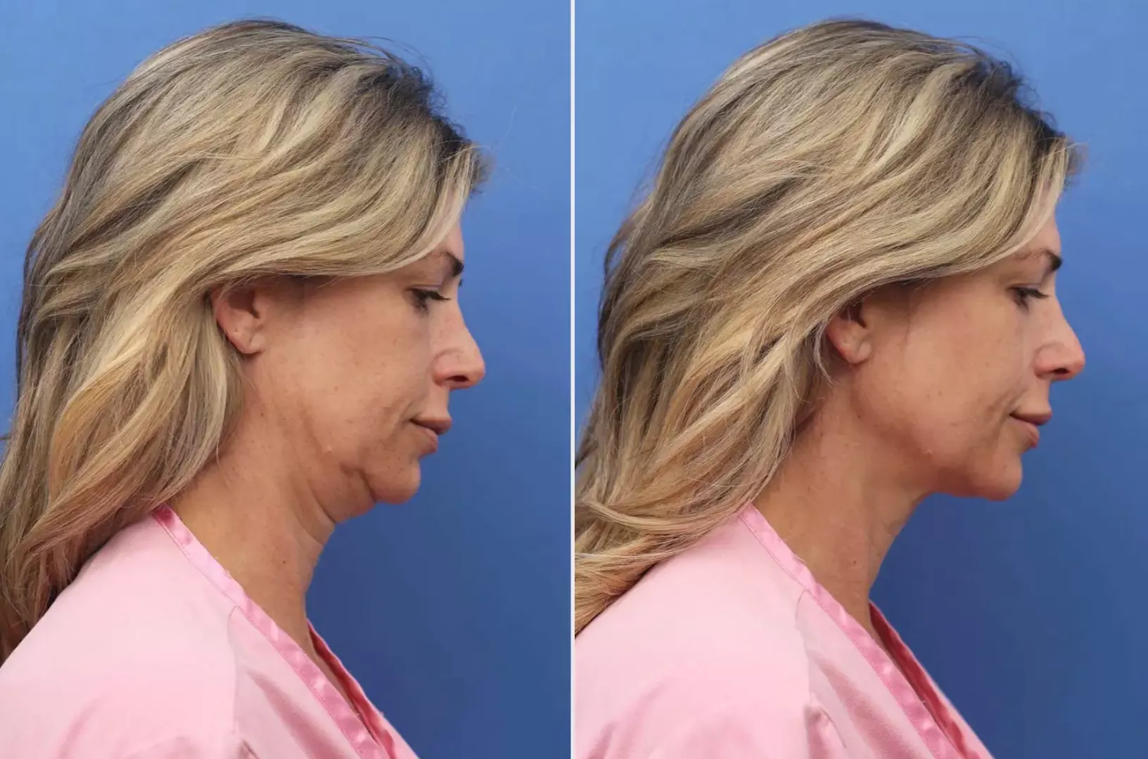 Alexis Bellino