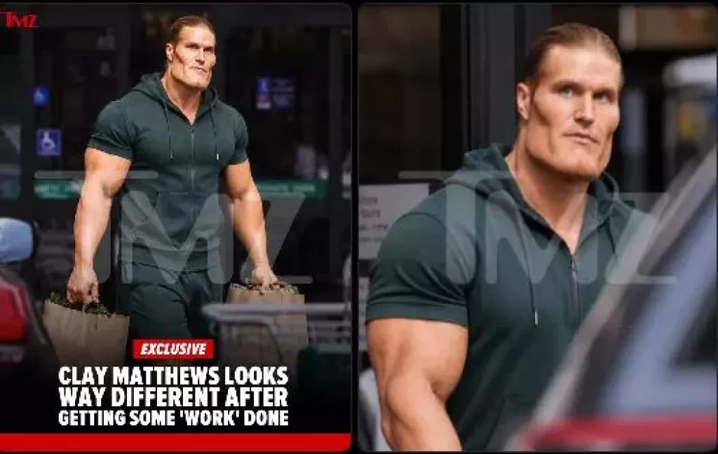 Clay Matthews 