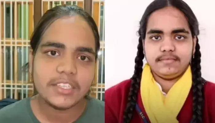 Class 10 Topper, Prachi Nigam SHUTS Trolls Shaming Her For Facial Hair: 'What Matters Are My Marks'