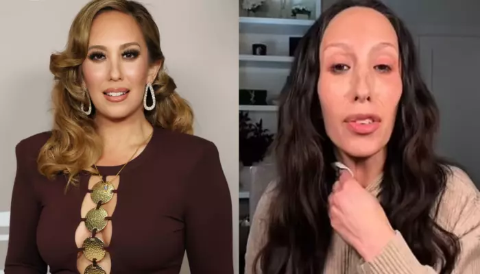 'DWTS' Judge, Cheryl Burke's Before And After Pic Surfaces, Has Denied Using Ozempic And Surgery