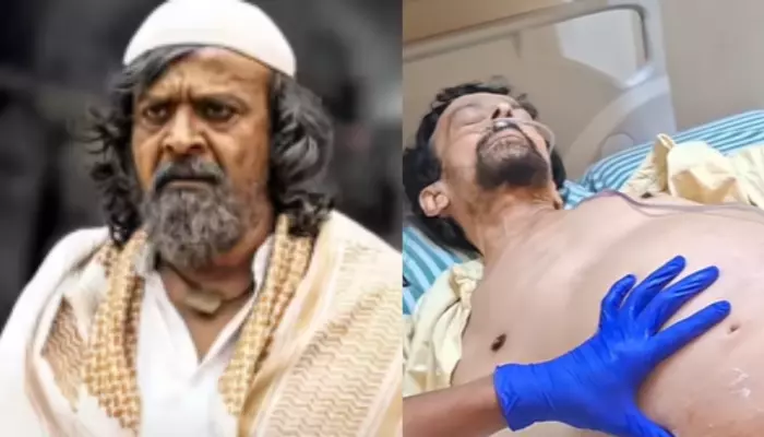 'KGF' Actor, Harish Roy Passes Away At 55 Due To Thyroid Cancer, Last Video From Hospital Surfaces
