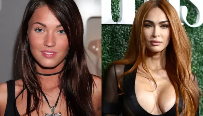Megan Fox's Then-Vs-Now Photos Surface As She Looks Unrecognizable, Talks About Cosmetic Surgery
