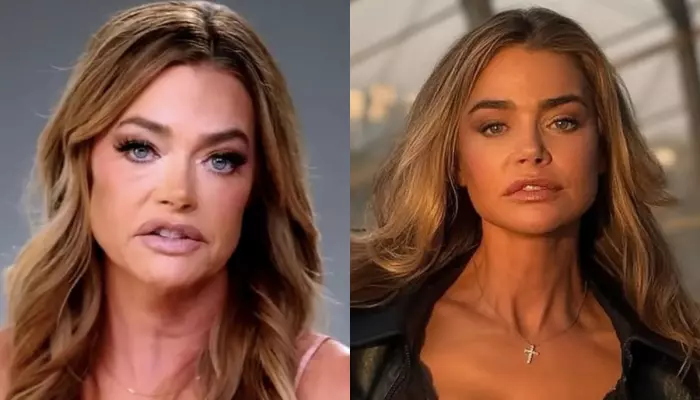 Denise Richards' Facelift Pics Resurface As She Recalls Ex-Husband's Botched Plastic Surgery Remark