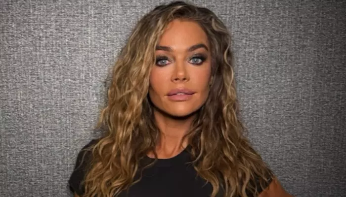 Denise Richards Says Ex-Husband's 'Botched' Facelift Remark Inspired Her To Open Up About Procedure