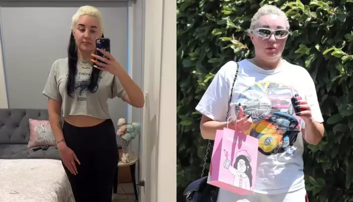 Amanda Bynes Didn't Like Herself In Last Movie, Decided To Step Away, Started Ozempic To Feel 'Cute'