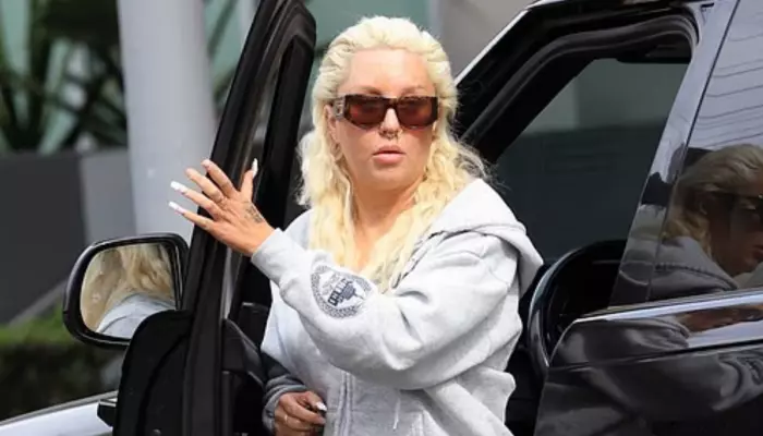 Amanda Bynes Spotted In LA Amid GLP-1 Treatment, Flaunts Gold Grills And Nose Piercings