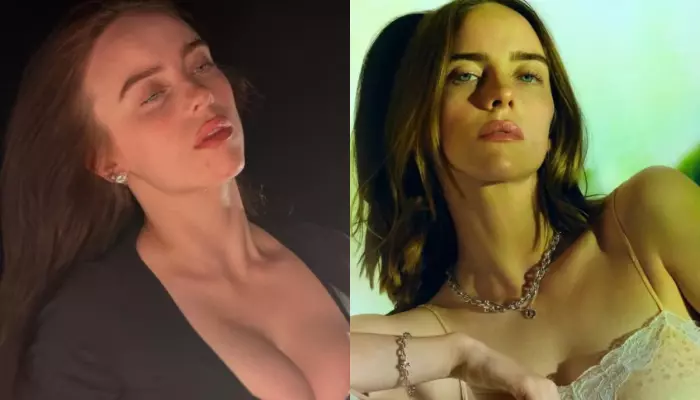 Billie Eilish Sparks Breast Reduction Rumors With Her New Look, Did She Undergo Plastic Surgery?