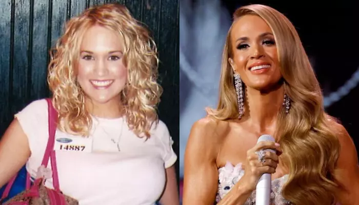Carrie Underwood's Mar-A-Lago Face Claims, Old Remark On Plastic Surgery Surfaces After Huge Injury