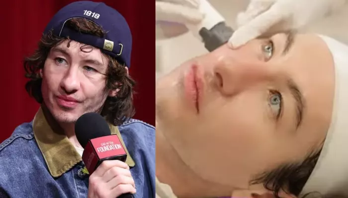 Barry Keoghan's Old Photos Surface Amid USD 6K Beauty Treatment After Facing Abuse Over His Looks