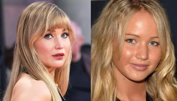 Jennifer Lawrence Opens Up About The Truth Behind Her Nose Job Rumours, 'My Cheeks Got Smaller'