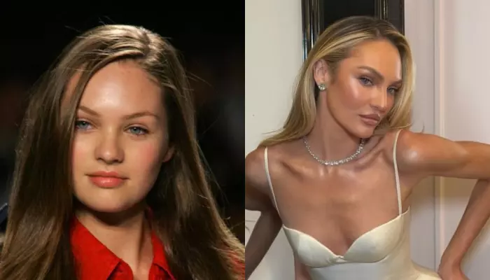 Candice Swanepoel's Dating Buzz With Tom Brady Raises Questions About Their Similar Cosmetic Tweaks
