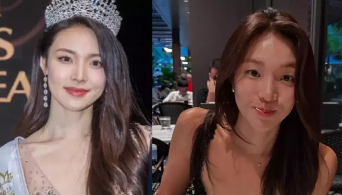 'Single's Inferno 5', Did Choi Mina Sue Undergo A Nose, Chin Along With Double Eyelid Surgery?