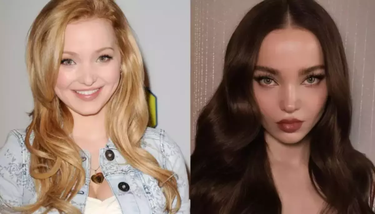dove cameron plastic surgery reddit Image 4
