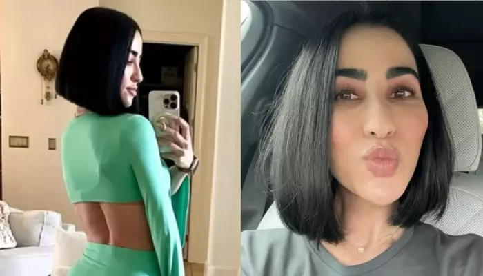 Stephanie Buttermore Spoke On Her Weight Gain And Body Image After Vein Leg Ablation Surgery