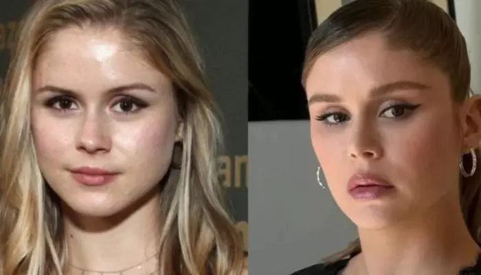 Erin Moriarty's Fans Feel She Underwent Buccal Fat Removal, As Before And After Pics Of Her Surfaces