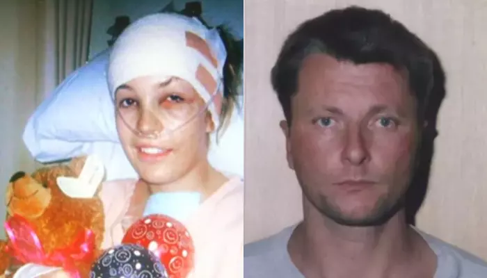 Where Is Lauren Huxley Now? Was Left In A Coma With 5% Chances Of Survival After Being Attacked