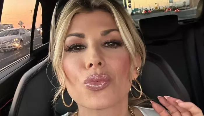 'Real Housewives' Alexis Bellino Bought Herself A Facelift For Her 50th Birthday, 'Look Amazing..'
