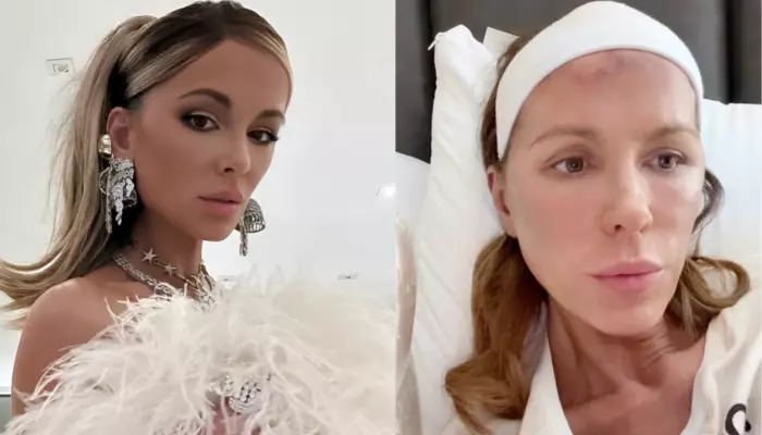 Kate Beckinsale Gets Candid About Navigating PTSD After The Death Of Her Mom, 'A Level Of Horror..'