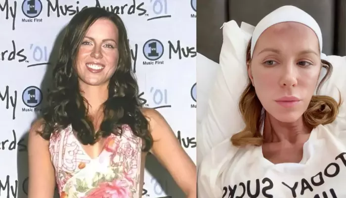 Kate Beckinsale's Shocking Weight Loss Transformation Sparked Ozempic Buzz, She Hit Back At Critics