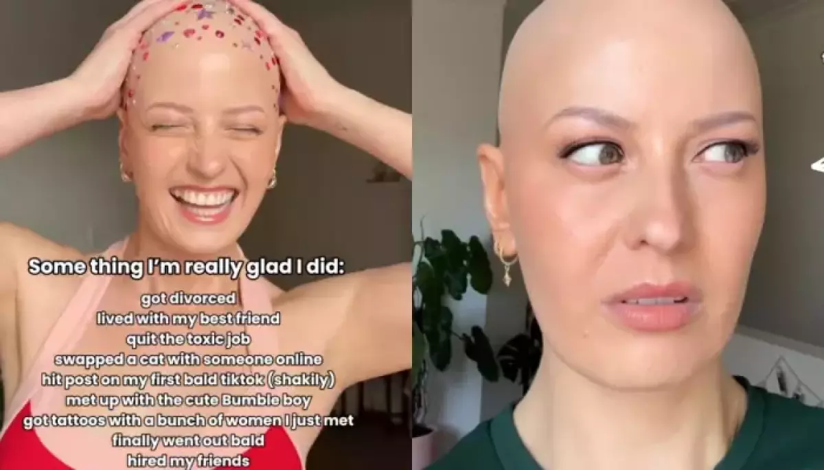Australian Creator, Holly Who Lost Her Hair At 6, Finally Shows Off Bald Head As She Ditches Wig